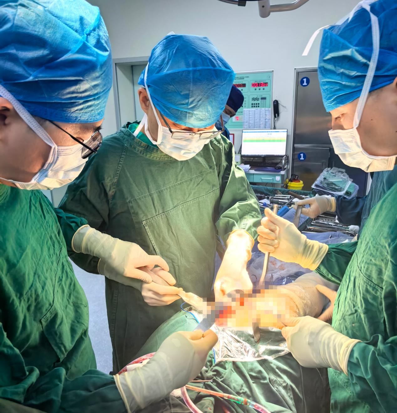 “X型腿”复原记——胜利油田中心医院完成超高难度膝关节置换术