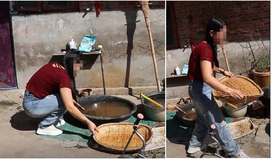 先髋高脱5厘米，济南关节外科医院为患者焕新双髋找回健康生活