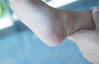 手足口病秋季小高峰，个人、家庭、学校、托幼机构防护要点来了