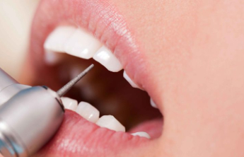 每天都刷牙，为啥还是会口臭？都是这个小东西在作祟