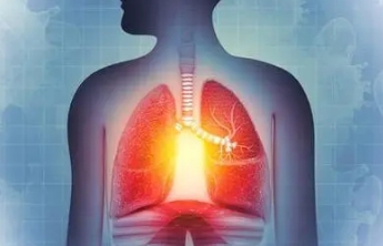 肺结节≠肺癌 专家建议这些人群应做胸部CT