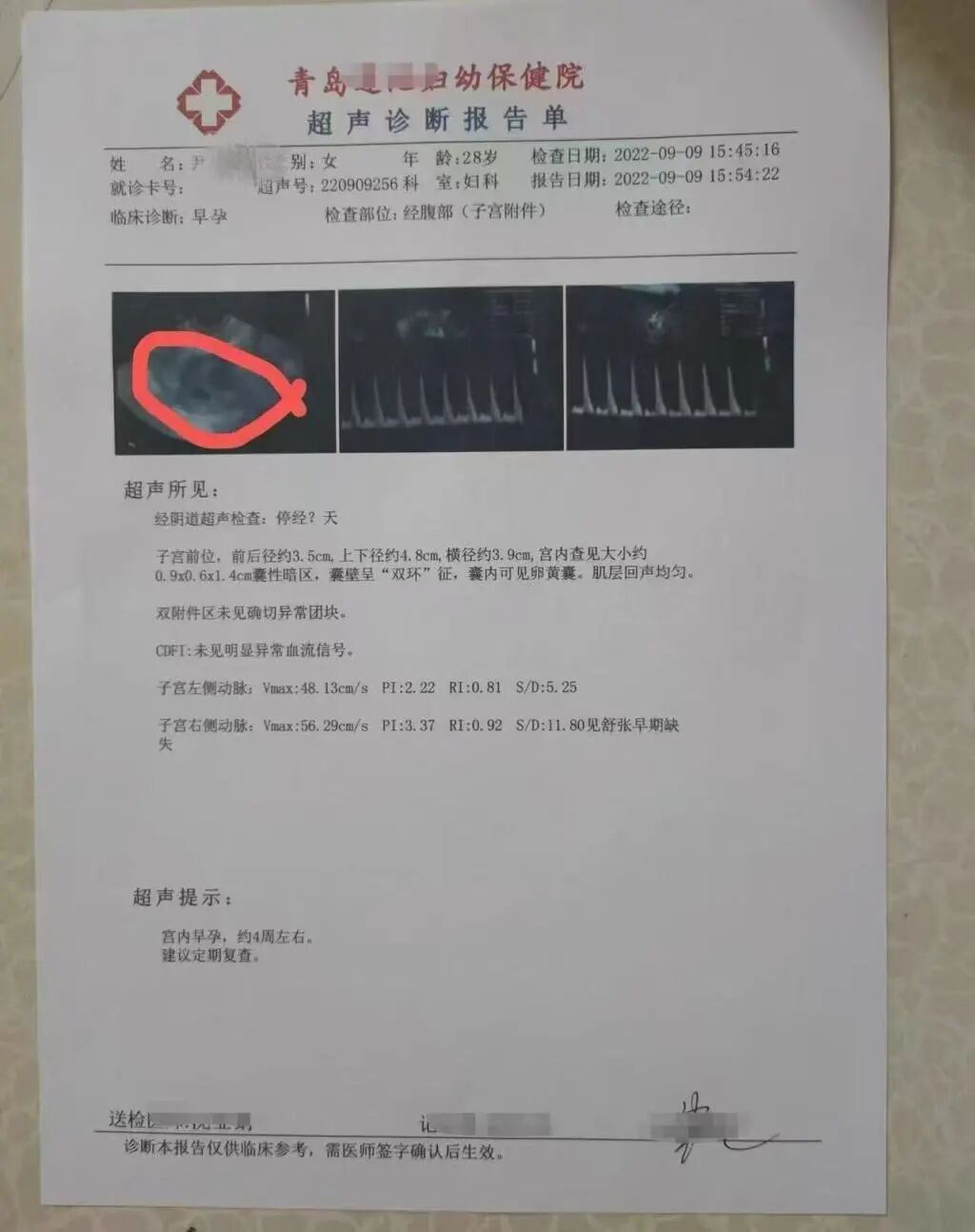 与不同男性交往过程中,尹某某也曾伪造医院b超检查单,谎称自己怀孕