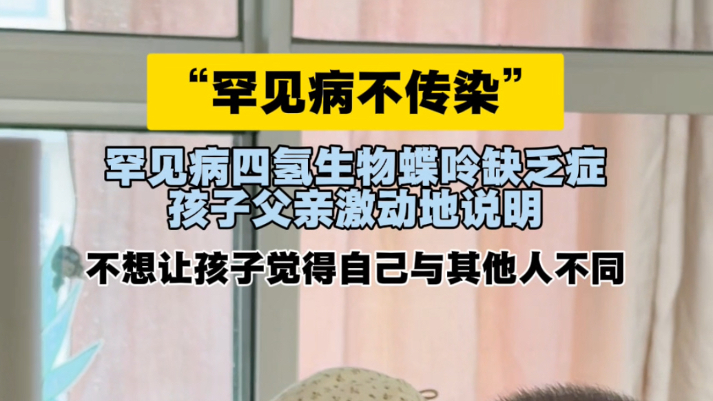 果然视频｜“罕见病不传染”，患四氢生物蝶呤缺乏症的牛牛父亲激动地说，不想让孩子觉得自己与其他人不同