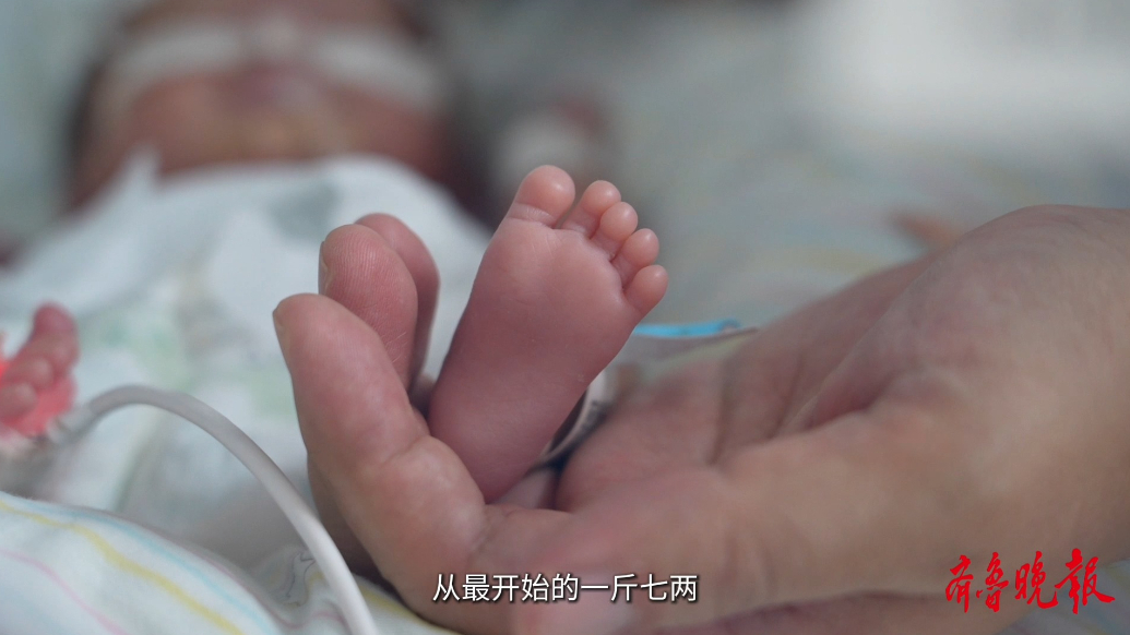 果然视频·医线直击|850克超早产宝宝的105天生命保卫战