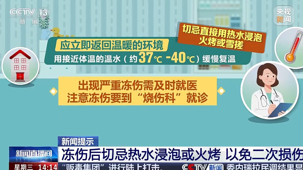 冻伤要到烧伤科就诊 手冻僵千万别直接用热水泡