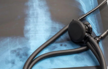 40岁以后，这两项体检就不要再跳过了