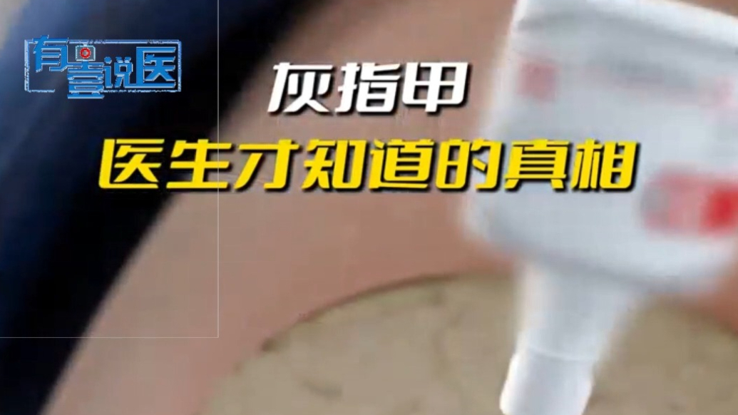 有壹说医|得了灰指甲后会有哪些常见的误区