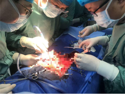 万名医护进乡村｜毓璜顶医院专家破局，完成招远首例血管缝合术