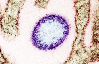 印度出现尼帕病毒疫情，专家解读