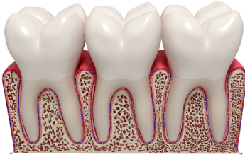 当心！牙周病与心脑血管风险的“强关联”
