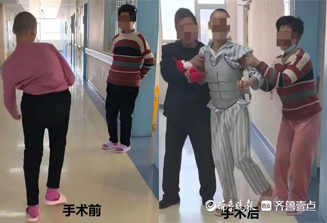 青岛故事丨14岁女孩“走弯”的人生，青大附院重新“扶正”