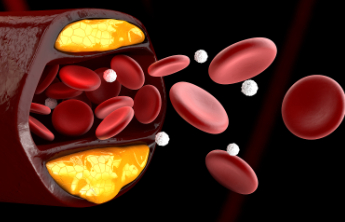 医生：能降“坏胆固醇”的食物，这3种效果最好