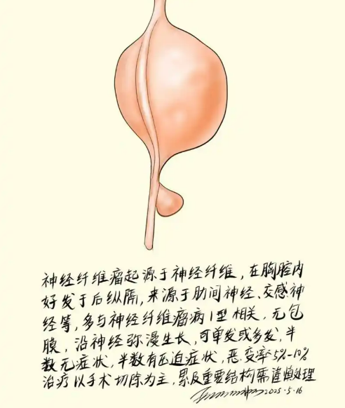 匠心治伤口，仁心护安康——泰安市第一人民医院伤口造口门诊精准攻克复杂创面修复难题