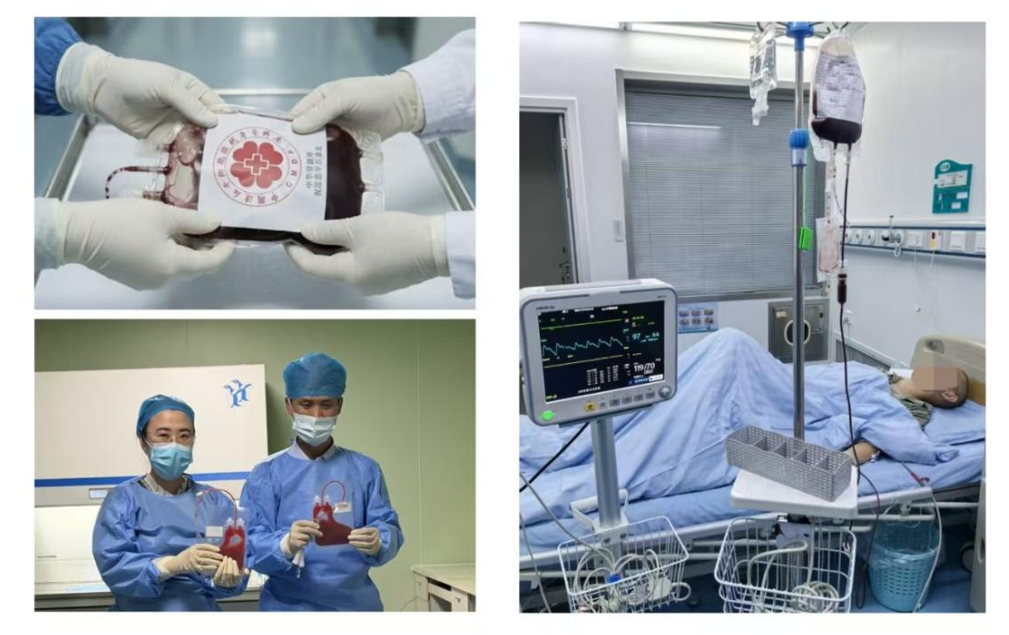 临沂市人民医院成功完成17岁患者非血缘异基因造血干细胞移植