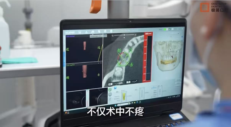 高龄种牙不用怕｜行业首家无痛医院，极简口腔解锁无痛诊疗新体验