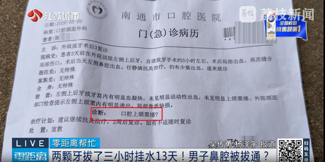 图片加载失败