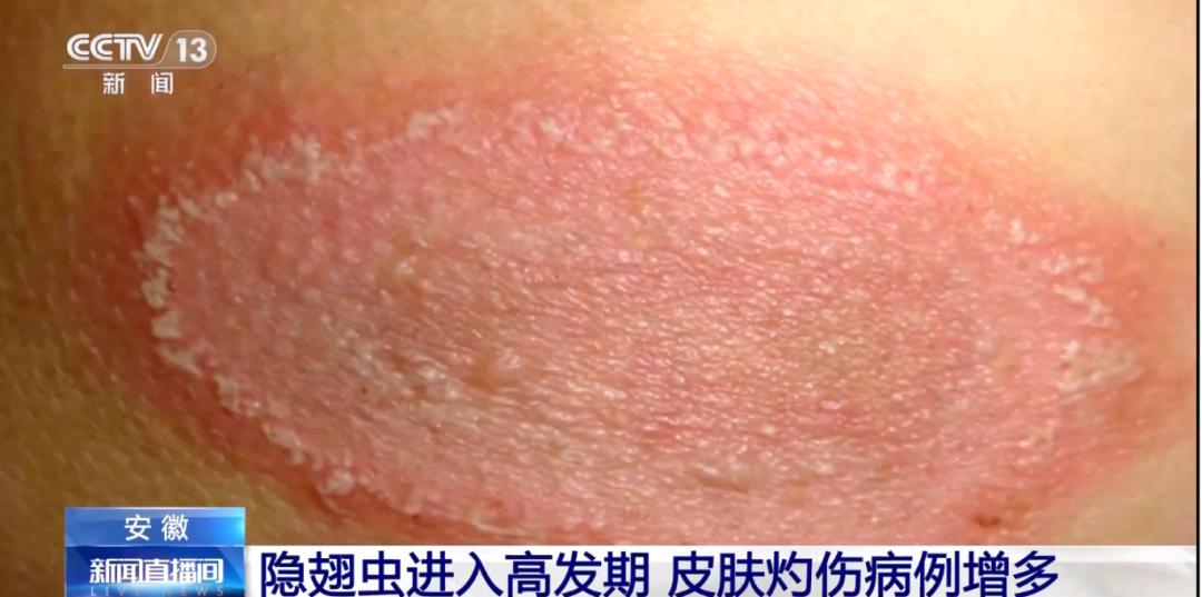 图片加载失败