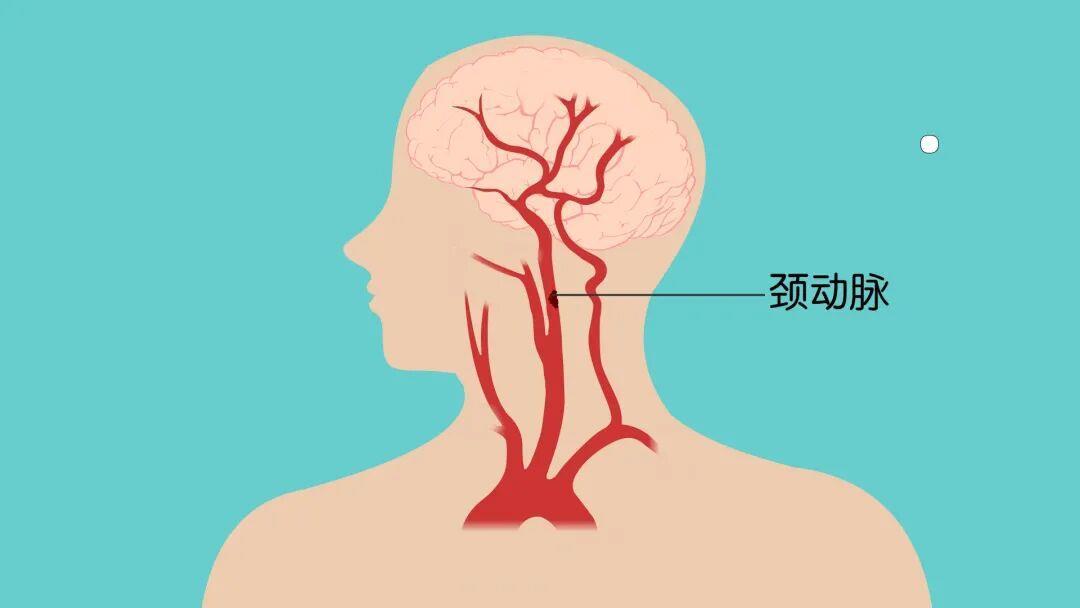 图片加载失败