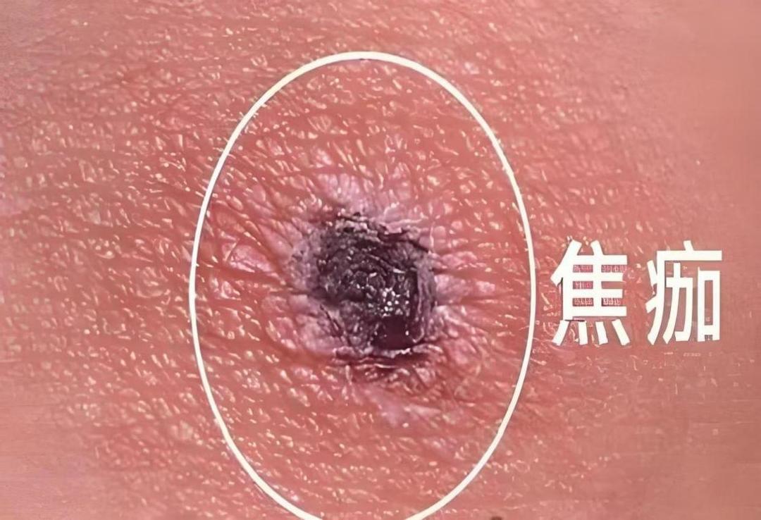 图片加载失败