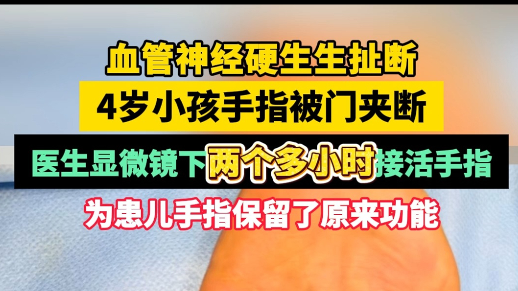 果然视频|4岁男童手指被门夹断，医生两个多小时显微镜下接活