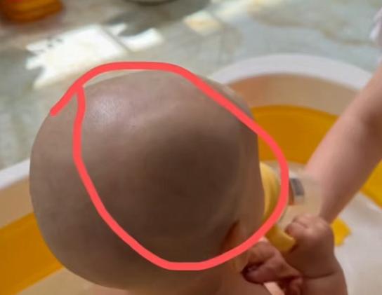 图片加载失败