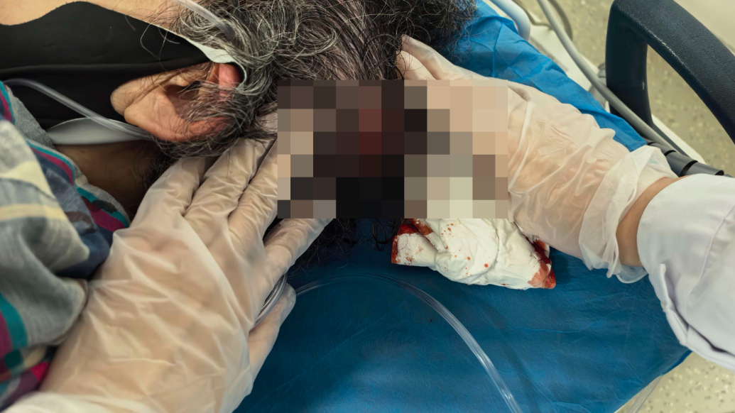 果然视频·医线直击丨八旬老人街边突发晕倒流血，省中医巡逻队紧急施救