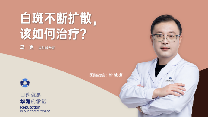 发展期白癜风，应该怎样治疗？