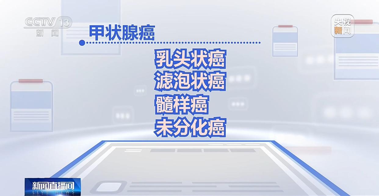 图片加载失败