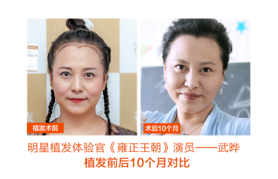 《雍正王朝》演员—武晔自诉