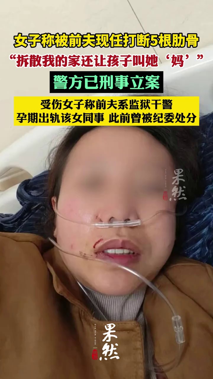 湖南女子称被前夫现任打断5根肋骨，“拆散我的家庭还让孩子叫她‘妈’”，警方已刑事立案