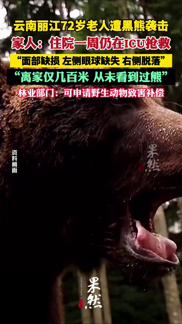 云南丽江72岁老人遭黑熊袭击 家人：事发地离家只有几百米，住院一周仍在ICU抢救（红星新闻）