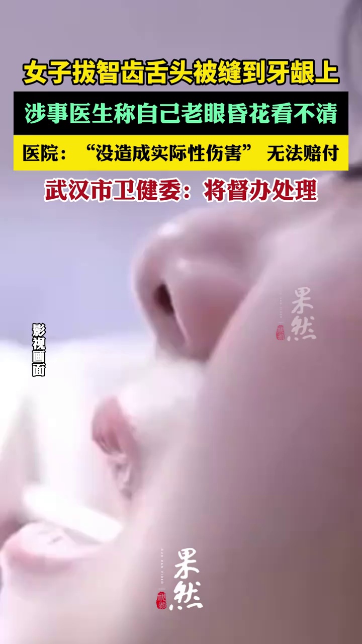 女子称拔智齿舌头被缝到牙龈上（现代快报）