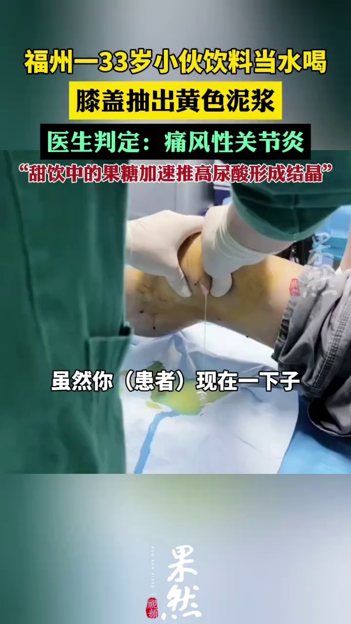 小伙饮料当水喝膝盖抽出黄色泥浆（南方都市报）