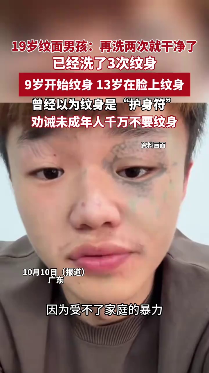 “纹面男孩”为自己的年少无知买单：已经洗了3次纹身，再有2次就洗干净了