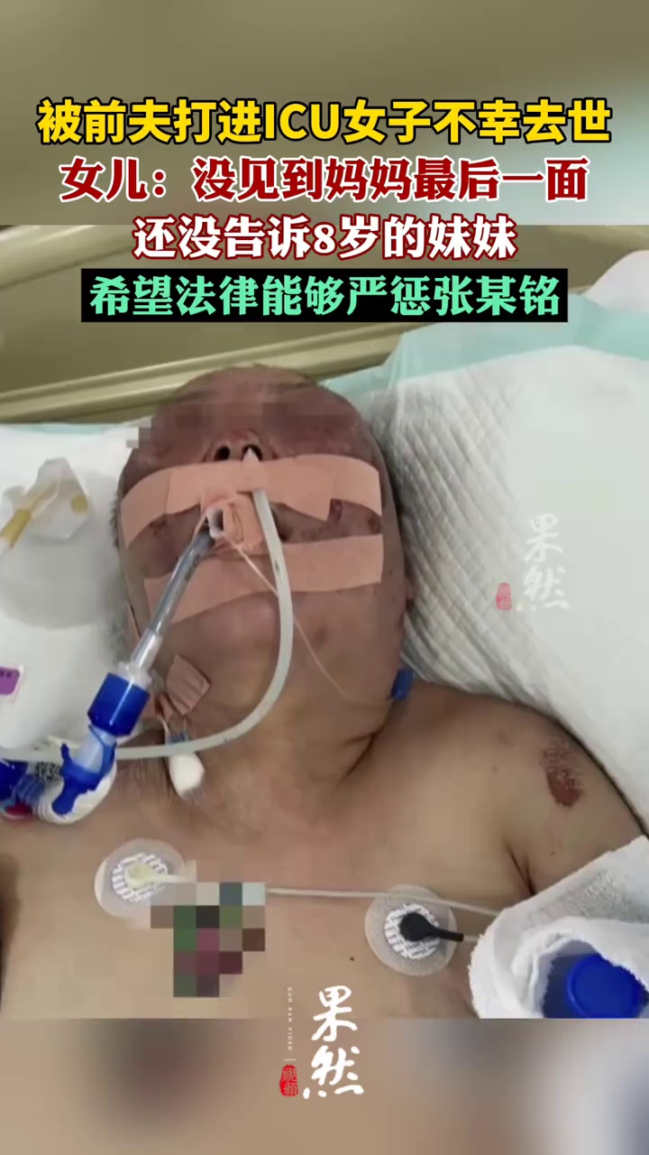 被前夫打进ICU女子不幸去世（现代快报）