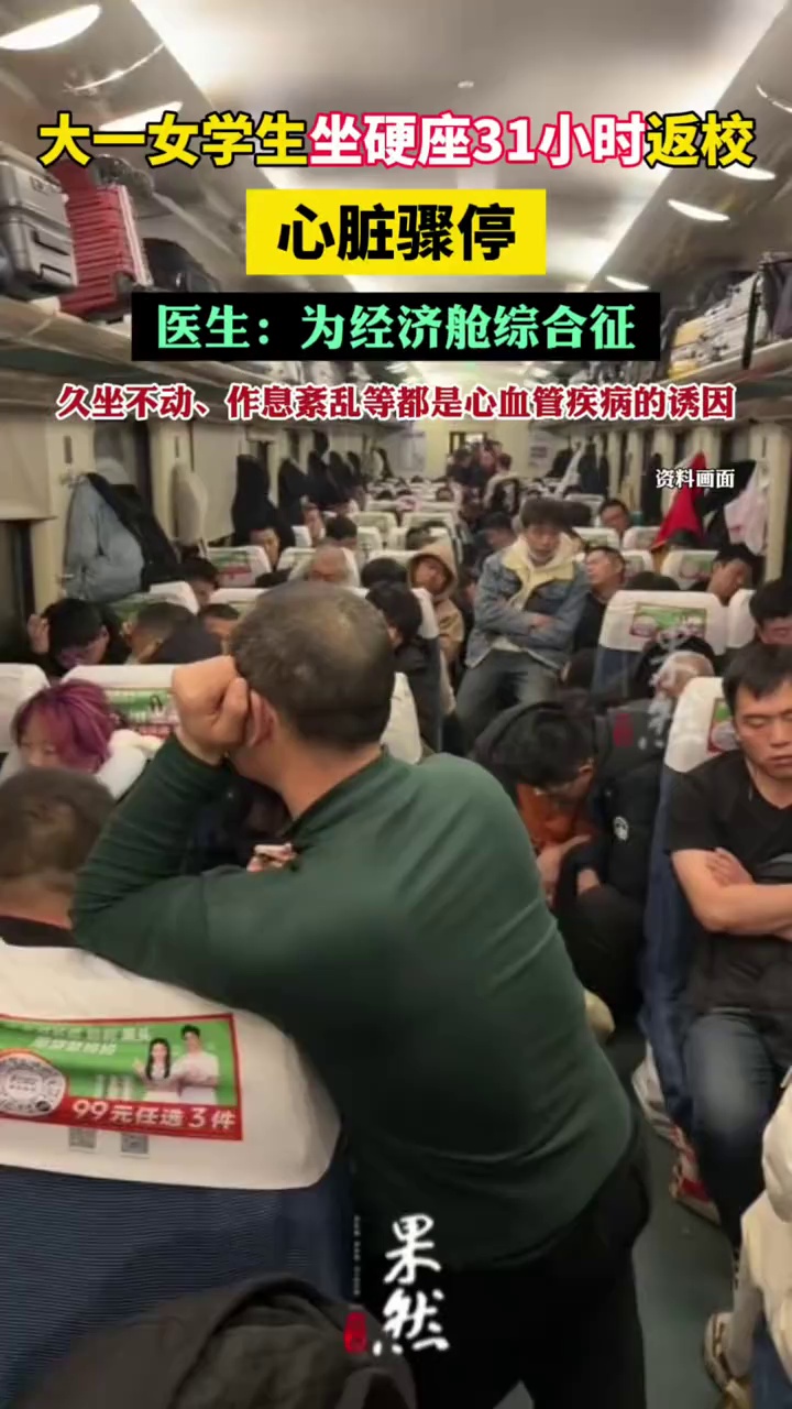 大一女学生坐硬座31小时返校心脏骤停，医生：为经济舱综合征