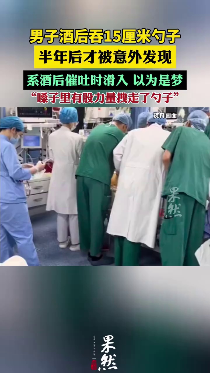 男子酒后吞15厘米勺子半年后才发现（澎湃新闻）