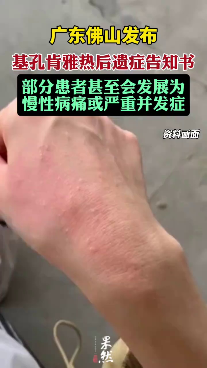 广东一地发布基孔肯雅热后遗症告知书（DV现场）