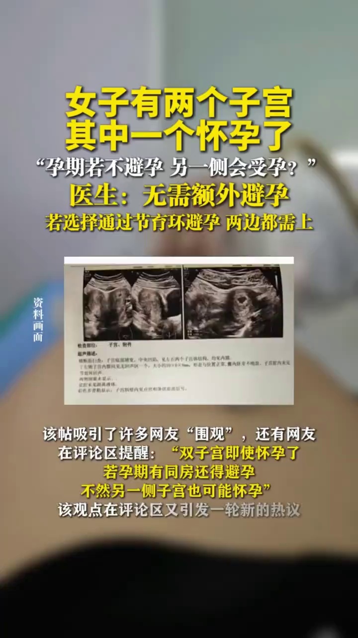 女子有两个子宫，医生在做检查时也感慨很少见
