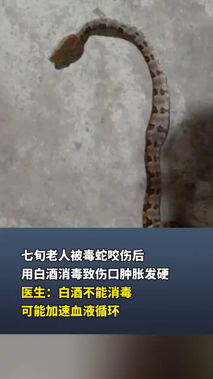 七旬老人被毒蛇咬伤后用白酒消毒，致伤口肿胀发硬，医生提醒！