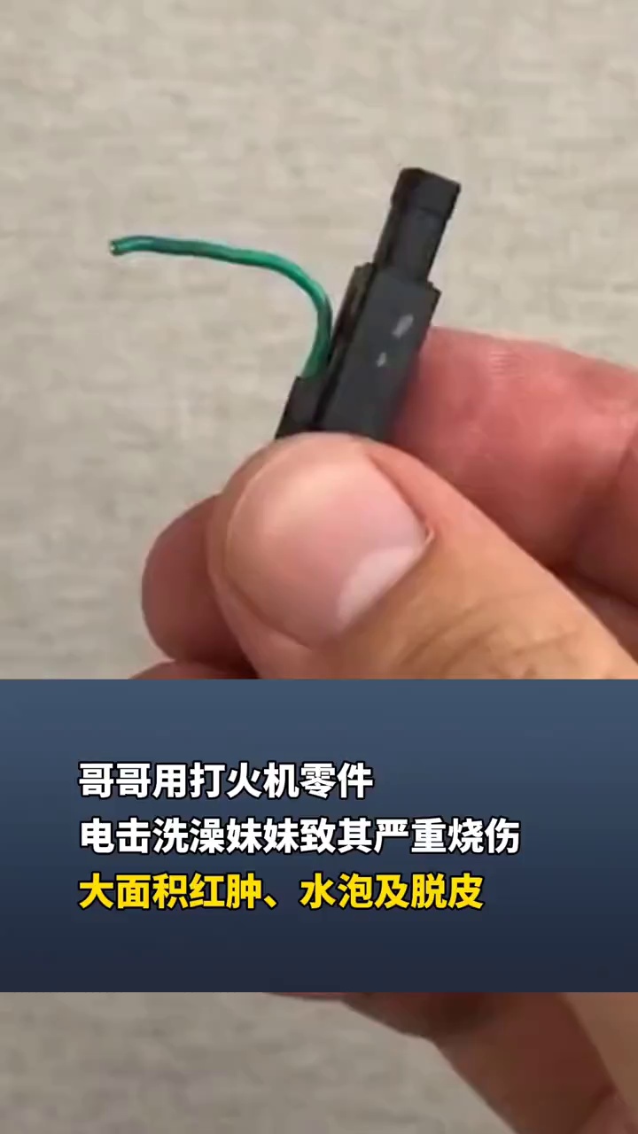 哥哥用打火机零件电击洗澡妹妹致其严重烧伤，大面积红肿、水泡及脱皮