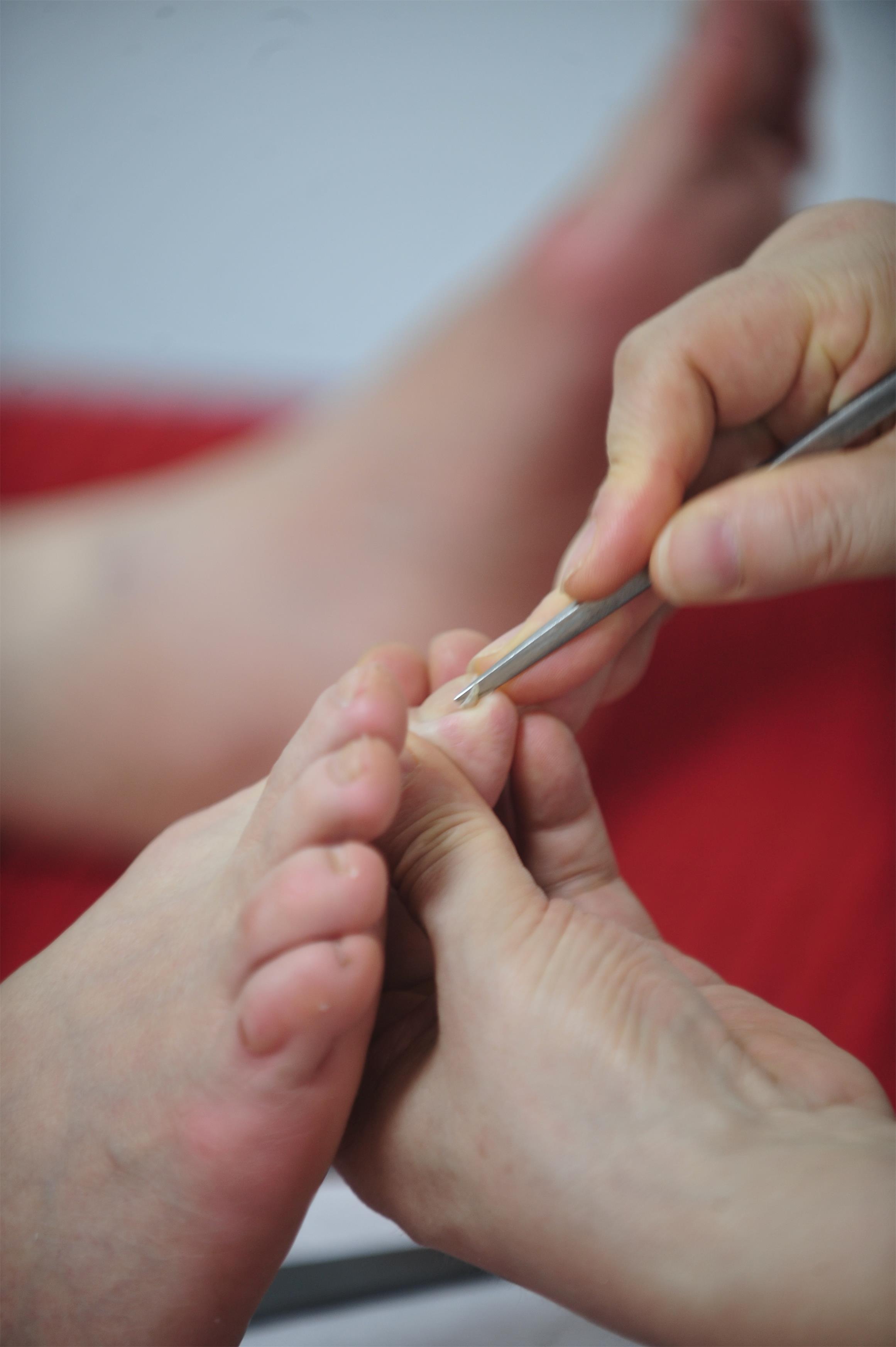 为老年人修脚三十年如一日葛一刀的修脚生涯