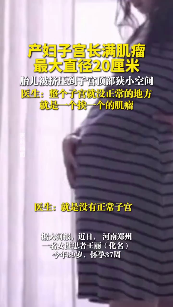 产妇子宫长满肌瘤，最大直径20厘米，胎儿被挤压到子宫顶部狭小空间