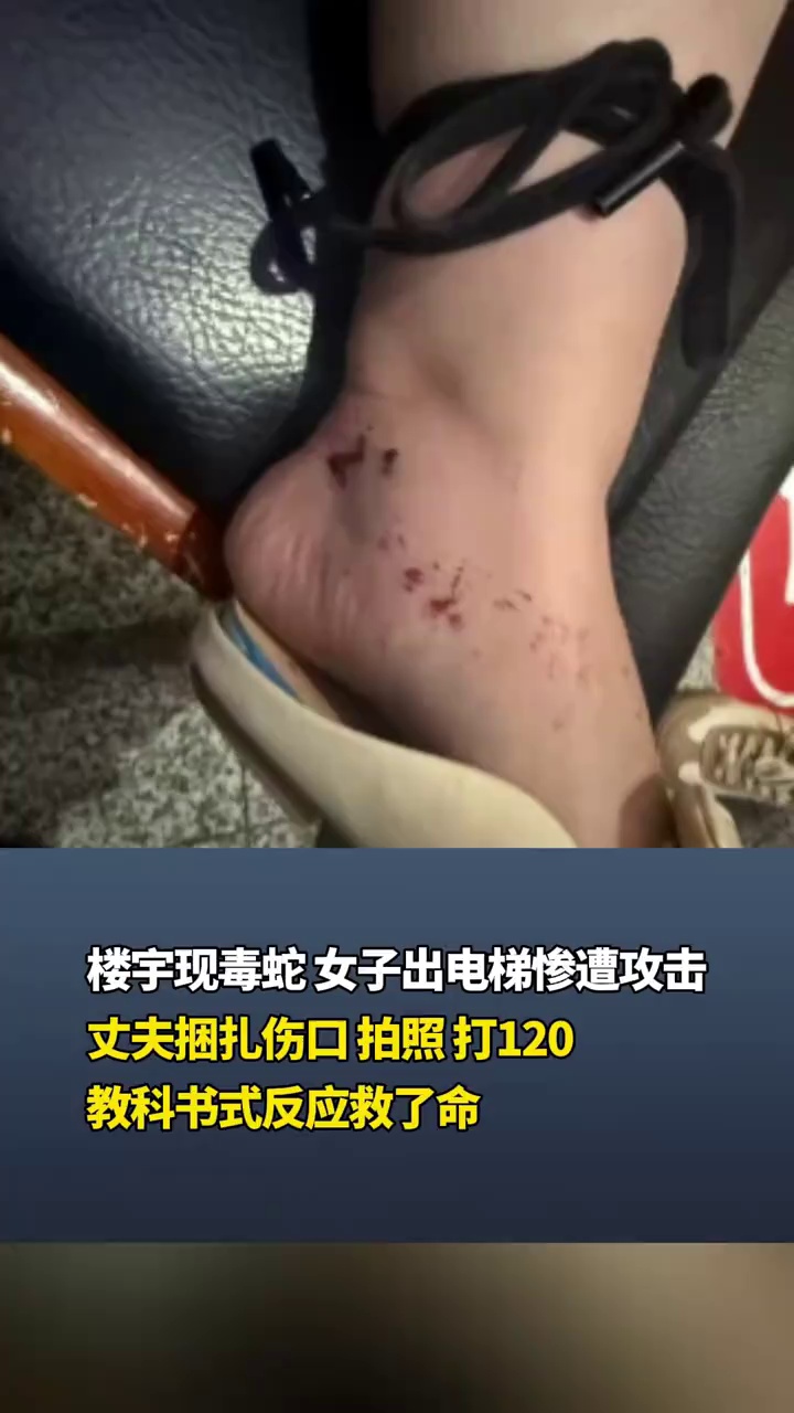 楼宇现毒蛇，女子出电梯惨遭攻击丈夫捆扎伤口、拍照、打120，教科书式反应救了命
