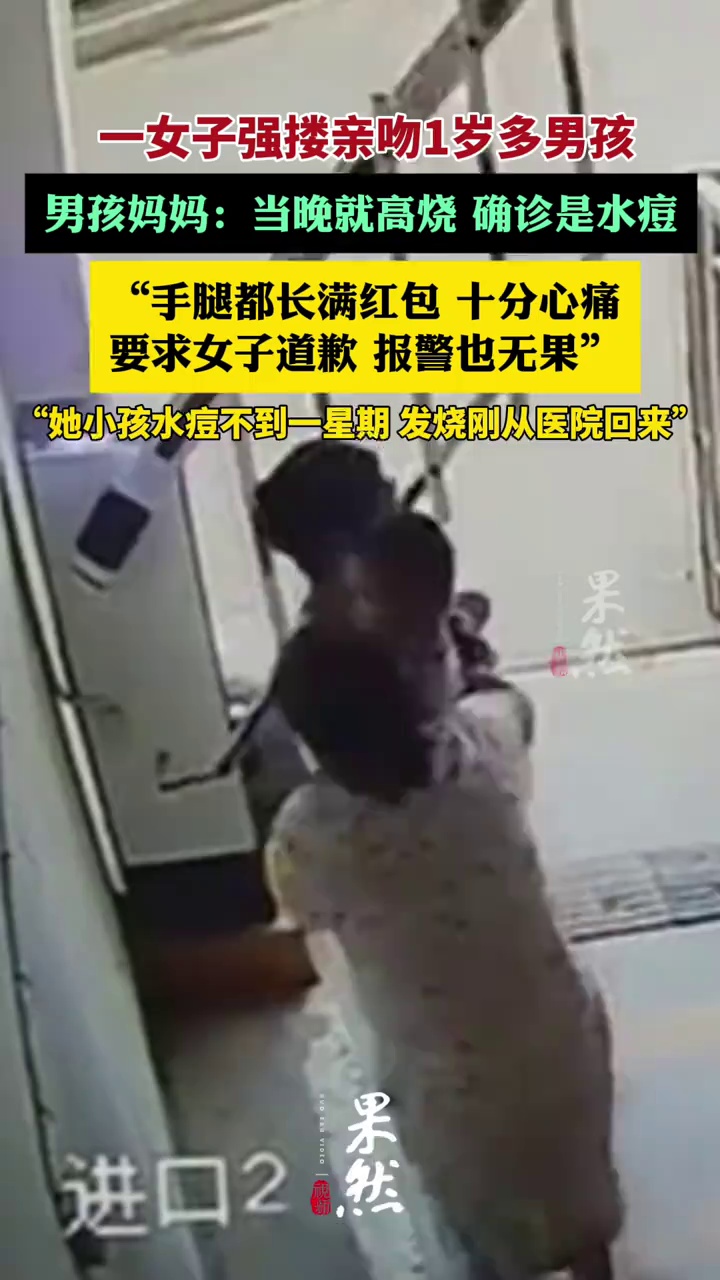一女子强搂亲吻1岁多男孩，男孩妈妈：孩子当晚就高烧，已被确诊是水痘（封面新闻）