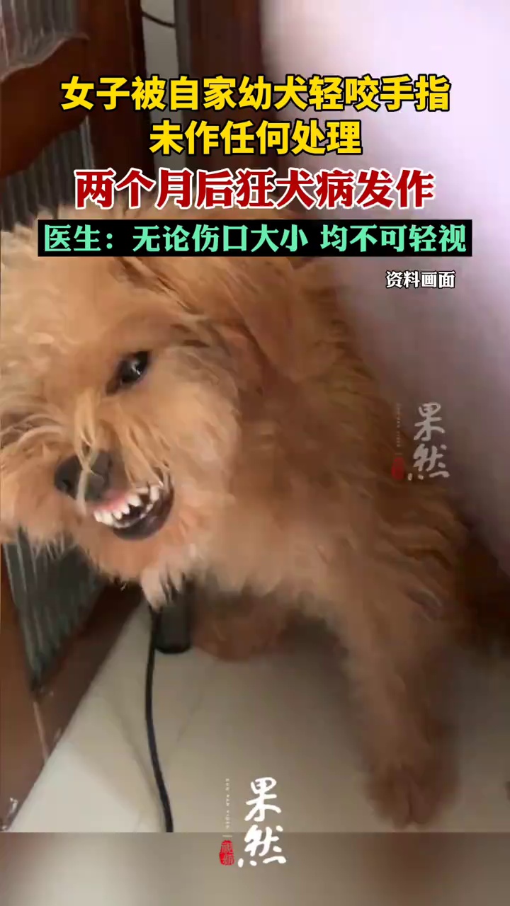 女子被狗咬2个月后狂犬病发作