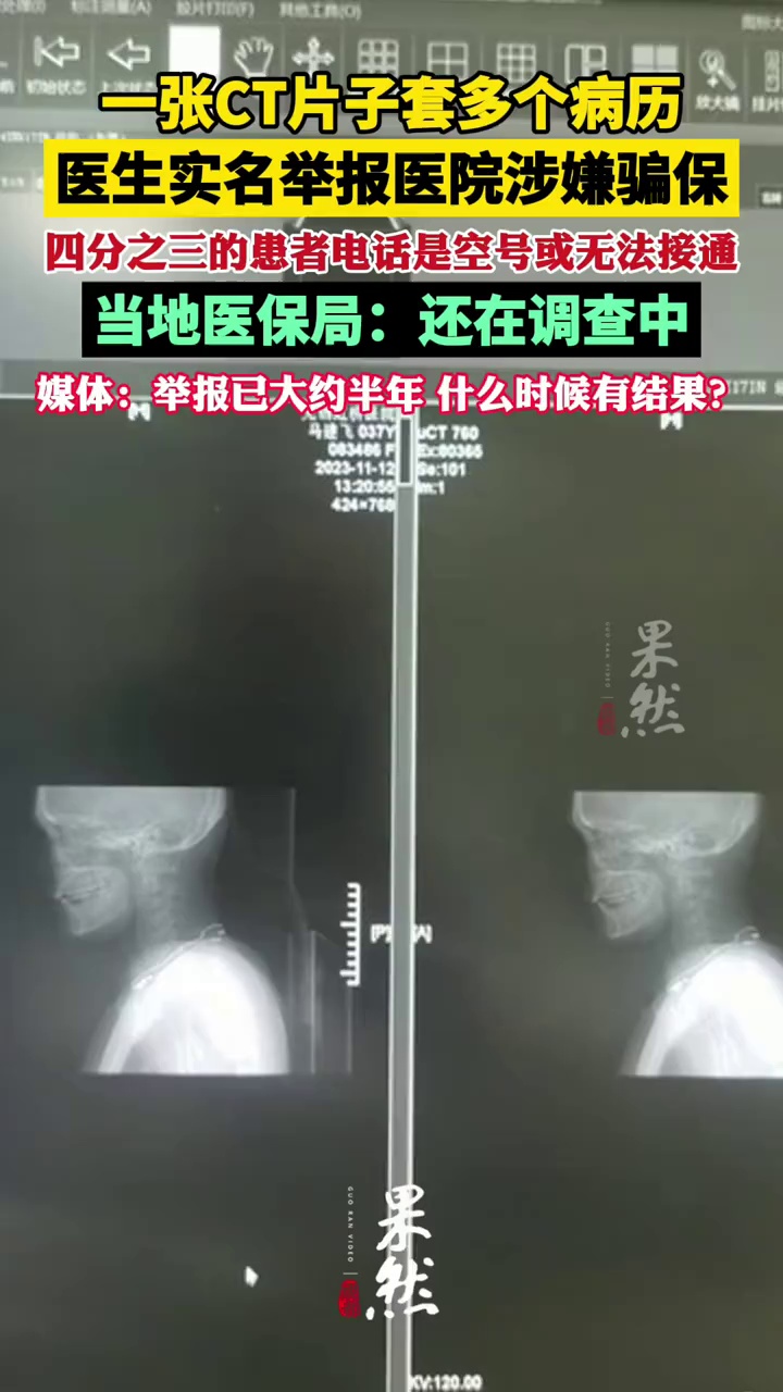 一张CT片子套多个病历，医生实名举报无锡虹桥医院涉嫌骗保