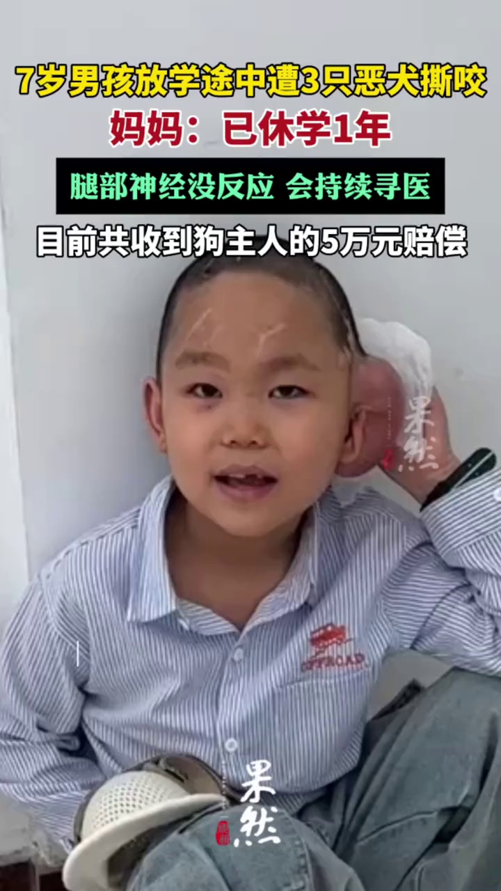 贵州7岁男孩放学途中遭3只恶犬撕咬（第1眼TV）@小郭同学很勇敢💪