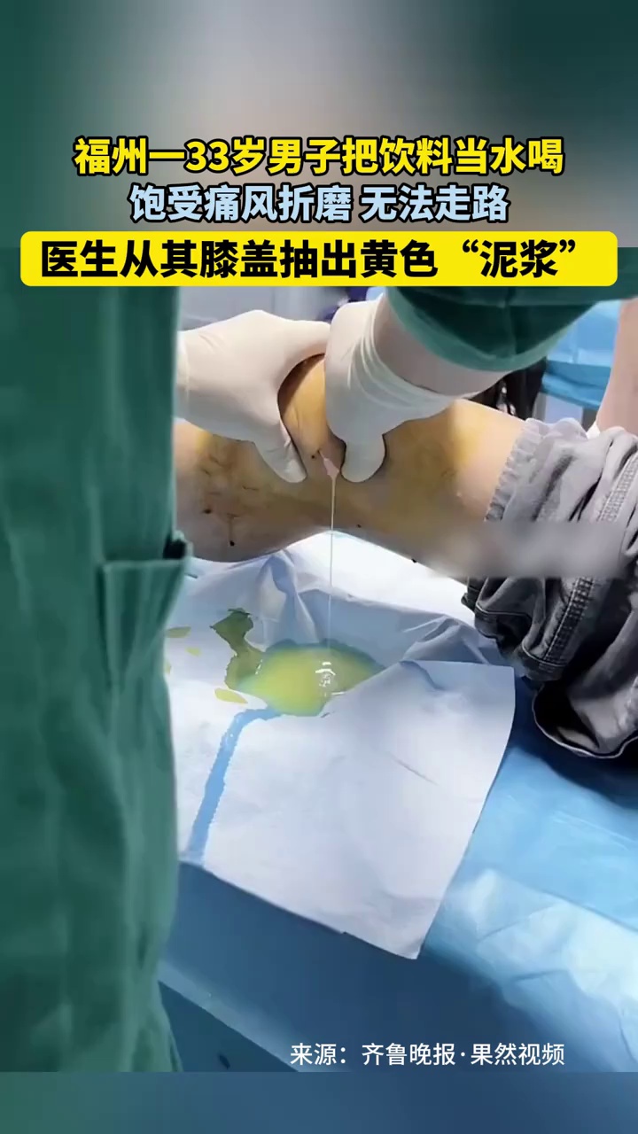福建福州一33岁男子把饮料当水喝，饱受痛风折磨，医生从其膝盖抽出黄色“泥浆”