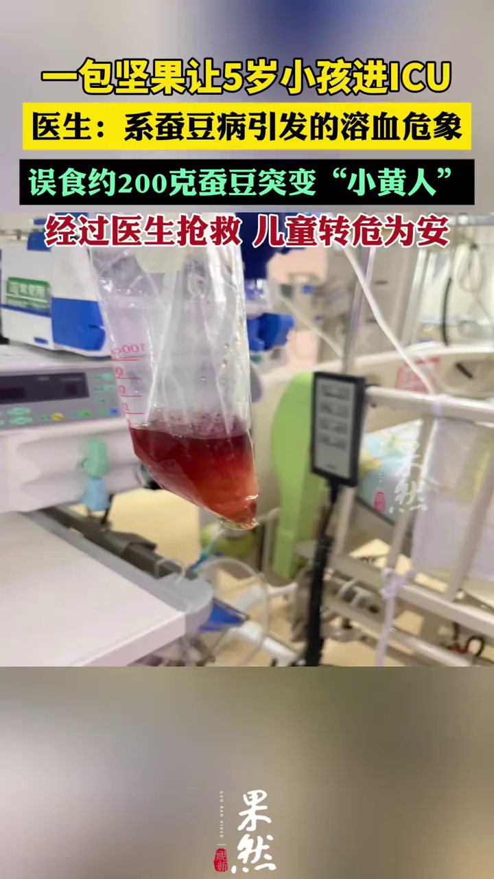 5岁男孩吃了一包坚果尿液如酱油（广州日报）